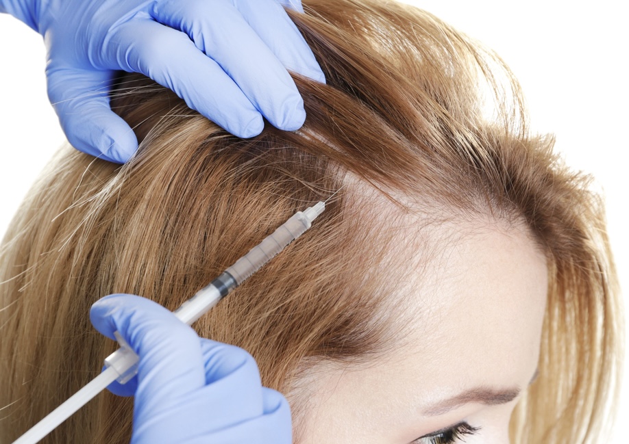 طرق عملية زراعة الشعر من خلال FUT وFUE