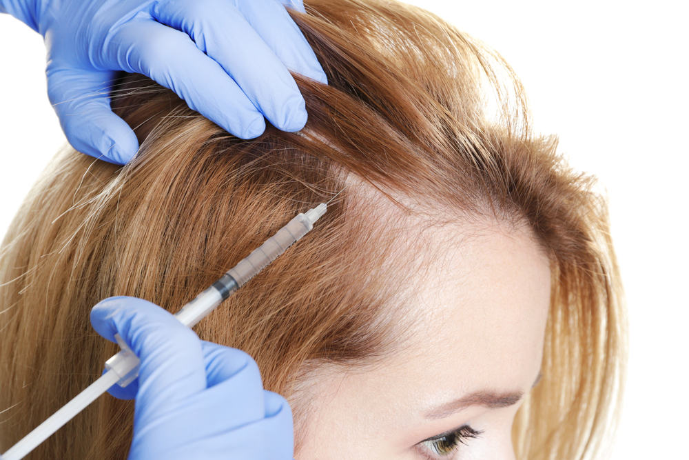 عمليات زراعة الشعر تساعد على علاج تساقط الشعر